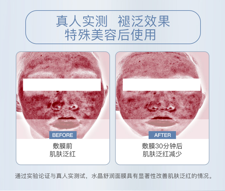 伊肤泉水晶舒润面膜 修护舒缓保湿 项目后敏感肌适用 【体验装】2片装
