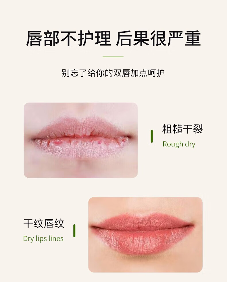 艾芭薇唇炎唇膏口角修护嘴唇部干裂开裂脱皮去角质烂嘴角痒护唇裂膏 唇膏买2鎹1 20g