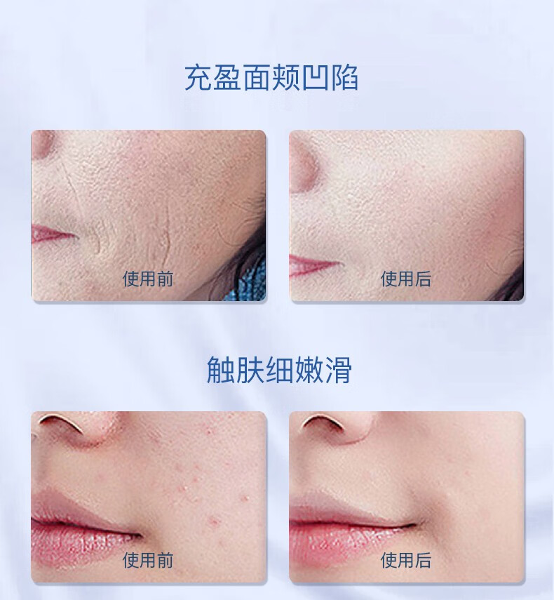 韩美素（Hanmeisu） 山羊奶滋养身体乳补水保湿滋润温和细腻滋养肌肤（到手两瓶） 【山羊奶滋养身体乳】200ml/瓶