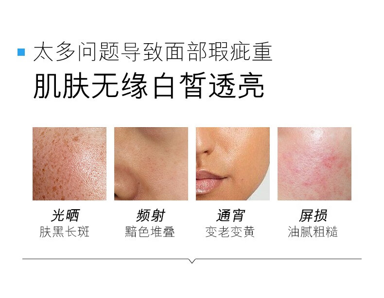 欧佩小白瓶美白精华液 30ml