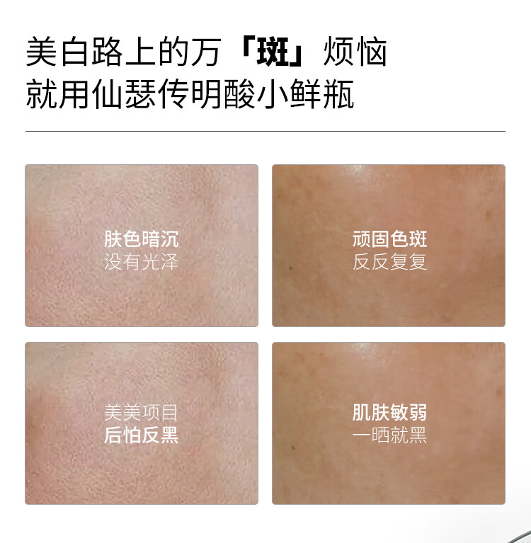 仙瑟传明酸精华氨甲环酸烟酰胺双合一美白淡化色沉预反黑