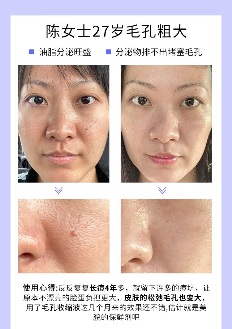 HMOT毛孔收缩精华液收敛毛孔粗大修复细致抗皱精华原液补水保湿男女士 1瓶体验装【推荐周期使用】