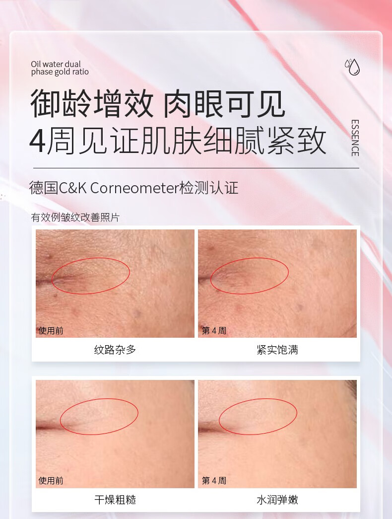 米加【直播专享】米加气泡油精华油愈感水光保湿补水修护褪红清爽 30ml