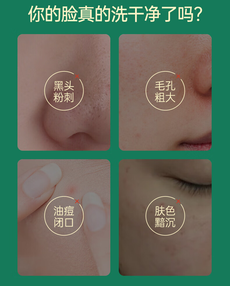 膜法世家绿豆清洁泥膜改善黑头闭口深层清洁毛孔面部祛痘控油提亮肤色男女 绿豆泥热销款【新版第九代】