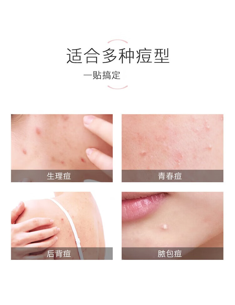 奕沃（EIIO）痘痘贴水杨酸青春痘净痘贴透明隐形遮痘印可上妆男女吸脓防水 eiio痘痘贴日用36贴+夜用26贴