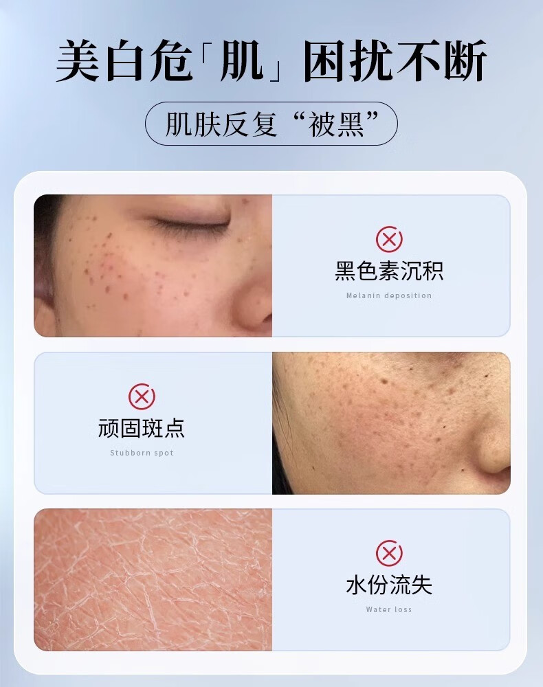 透真（LUCENBASE）377美白次抛精华液 VC淡斑痘印去黄提亮烟酰胺原液改暗沉补水保湿 【377美白淡斑】试用装-5支