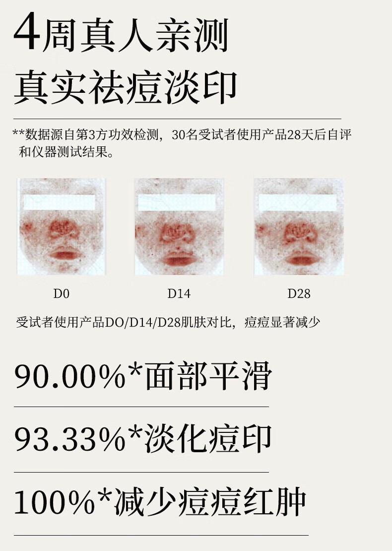 寻荟记发酵芦荟胶祛痘痘印补水保湿修护凝胶晒后舒缓芦荟胶50g芦荟原液 【2代新升级】祛痘芦荟胶50g*1支