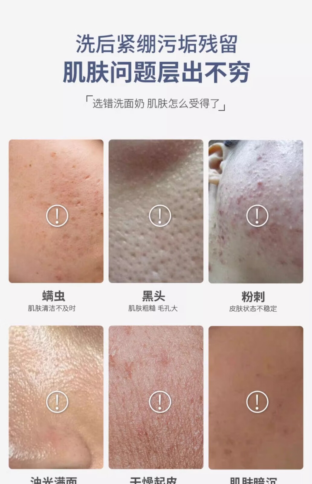 臻元shingen臻元洗面奶 氨基酸洁面乳男女清洁黑头 氨基酸洗面奶 160g