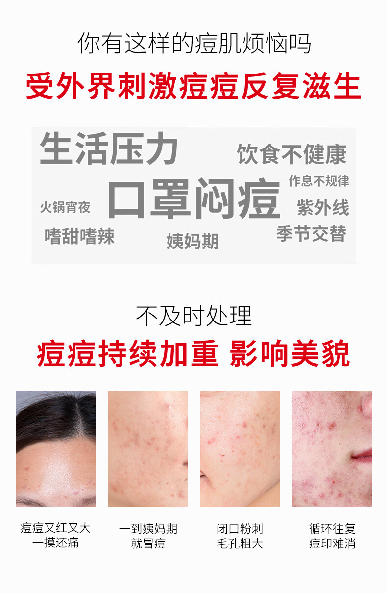 RYDEEN壬二酸祛痘膏凝胶淡化痘印痘坑青春痘成人痘粉刺黑头抗痘 1支