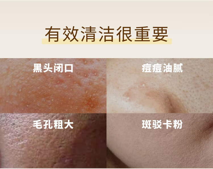 光言（GLOWSIS）【光言白泥】糙米复合酸清洁泥膜清洁控油去角质涂抹 大油田力荐-白泥100g