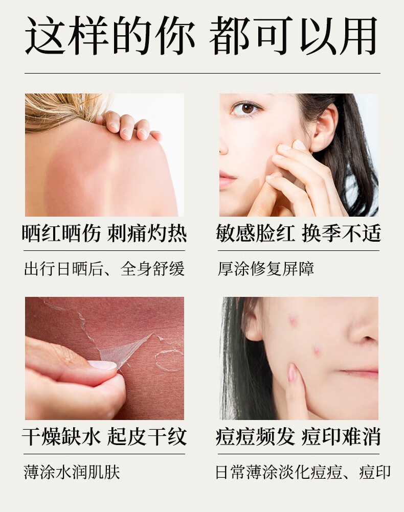 寻荟记发酵芦荟胶祛痘痘印补水保湿修护凝胶晒后舒缓芦荟胶50g芦荟原液 【2代新升级】祛痘芦荟胶50g*1支