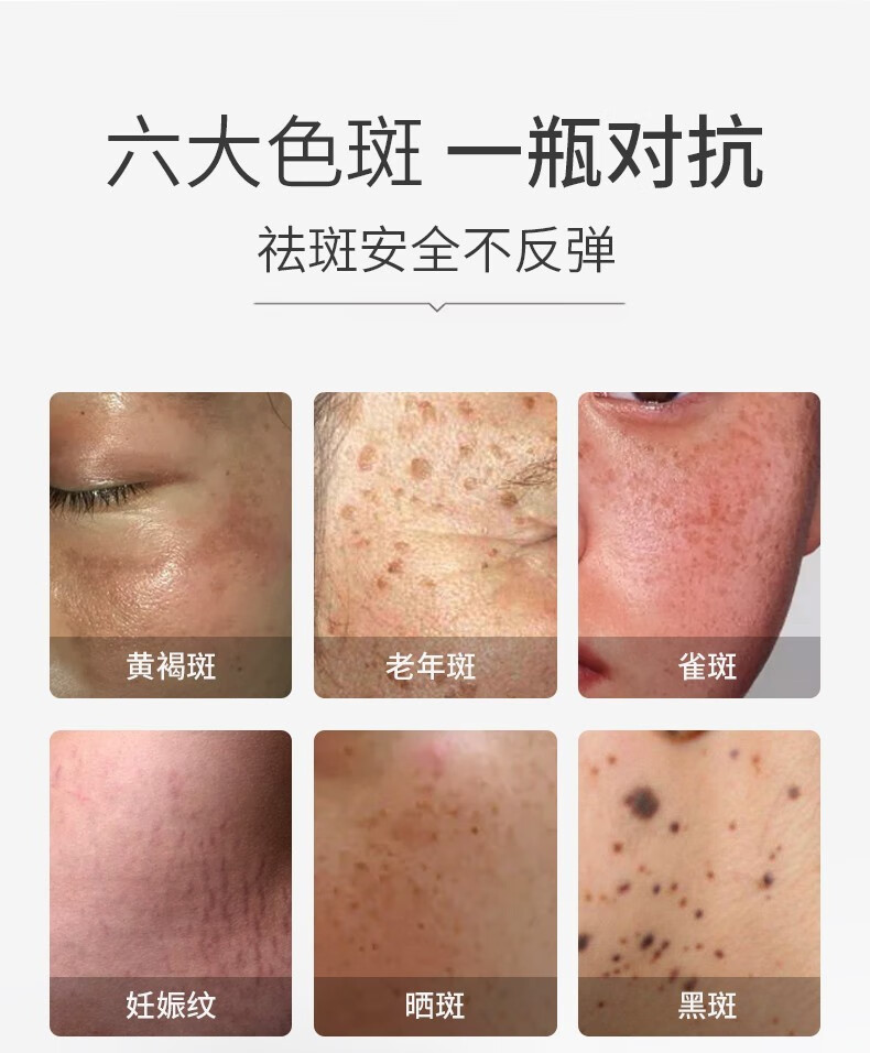 人仁和匠心修护美白祛斑霜 淡化斑烟酰胺精华膏提亮肤色保湿素颜熬夜 祛斑套装