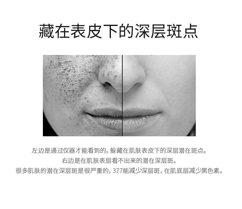 城野医生（Dr.Ci.Labo） 377美白精华液淡化痘印斑点早c晚a护肤品 中样6g