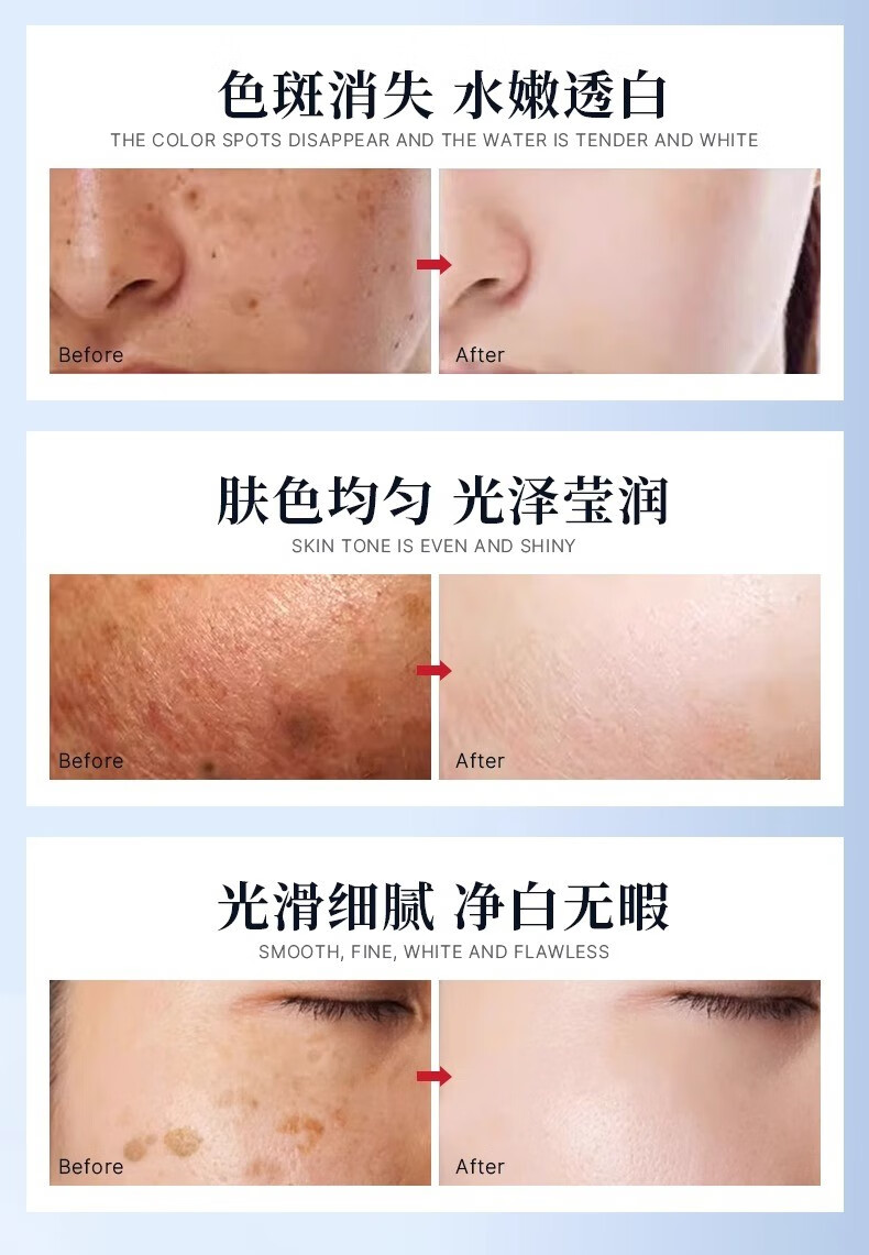透真（LUCENBASE）377美白次抛精华液 VC淡斑痘印去黄提亮烟酰胺原液改暗沉补水保湿 【377美白淡斑】试用装-5支