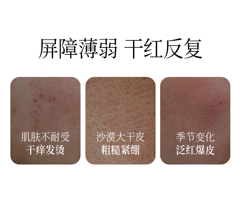 中草集人参籽舒缓修护润肤油30ml 面部精华舒缓肌肤修护水润