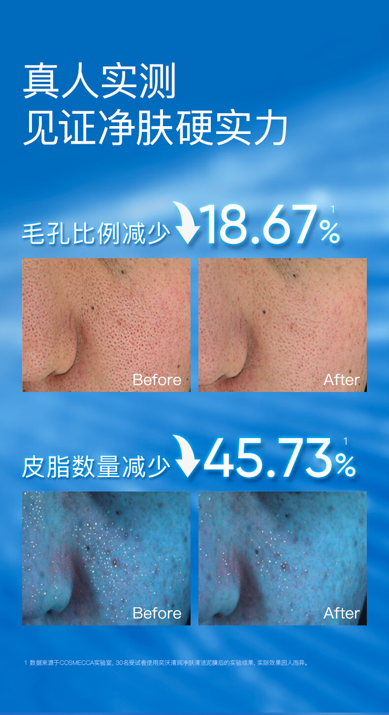 奕沃（EIIO）清洁泥膜祛痘去角质粉刺黑头闭口补水保湿舒缓白泥涂抹式面膜 【第二代】清洁泥膜100ml