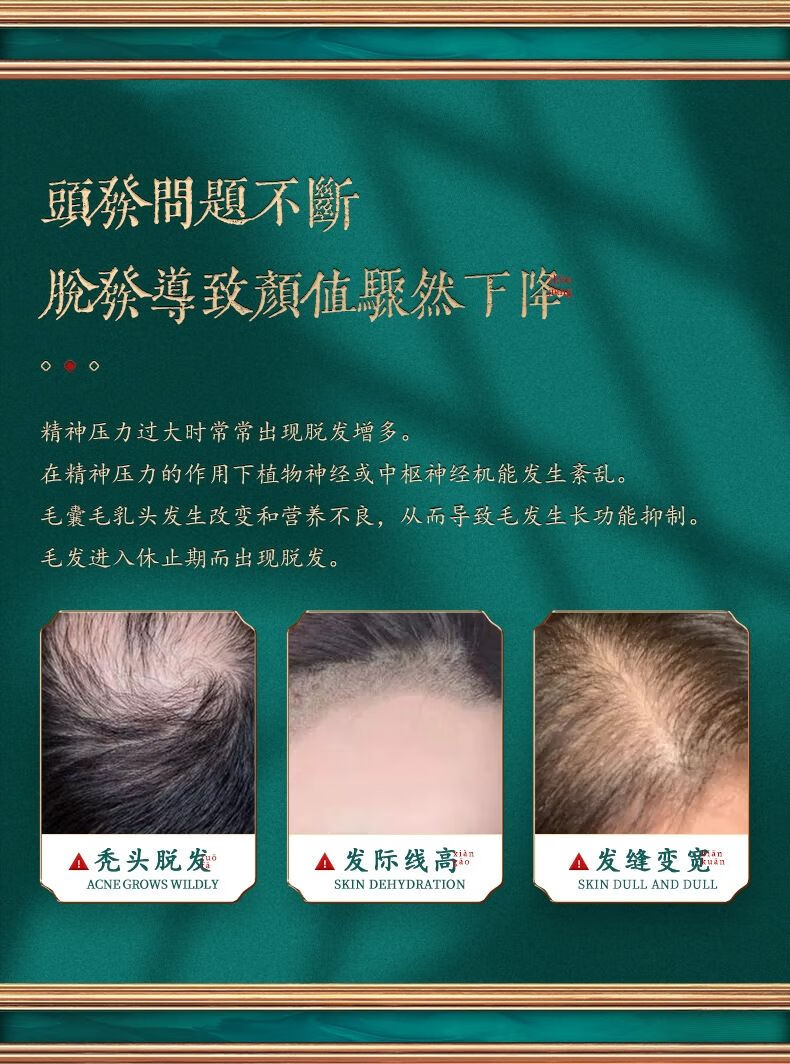 防脱洗发水生育发去屑控油生姜洗发露秃顶溢脂性脱发草本洗发液男女士 固发洗发水x2
