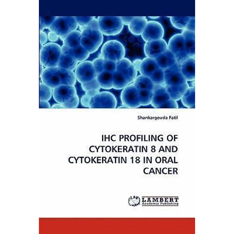 按需印刷Ihc Profiling of Cytokeratin 8 and Cytokeratin 18 in Oral Cancer[9783843352178]
