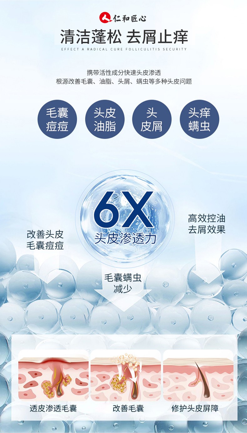 人 仁和匠心头皮毛囊洗发水炎除螨去屑止痒深层清洁头部油脂洗发露 一瓶