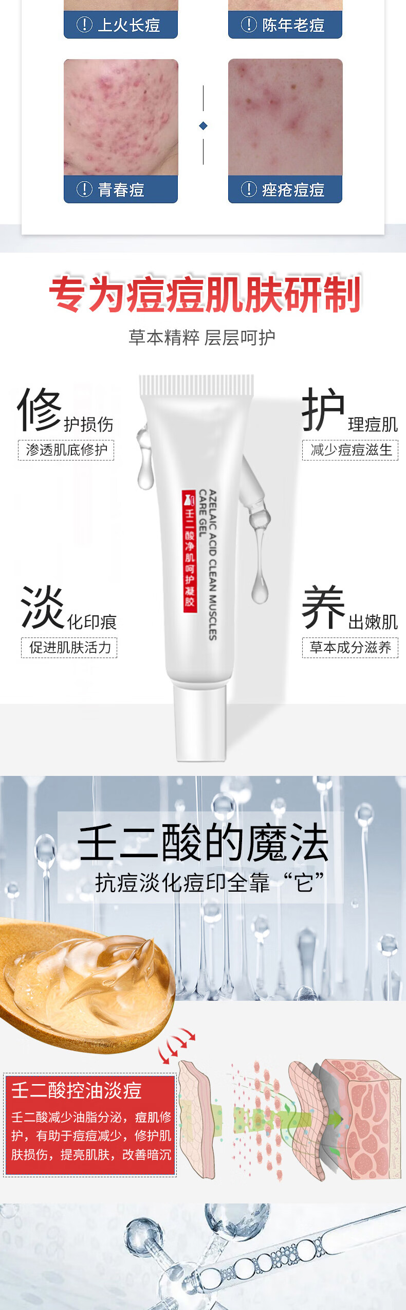 翼颜壬二酸凝胶15%软膏祛痘精华凝露水杨酸唑去淡化黑头粉刺痘印乳膏 壬二酸修护凝胶2盒