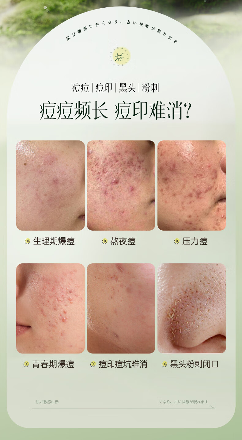 儒意水杨酸祛痘面膜淡化痘印补水保湿嫩白收缩毛孔控油修复男女士专用 25片赠3片【淡化红肿】祛痘消印