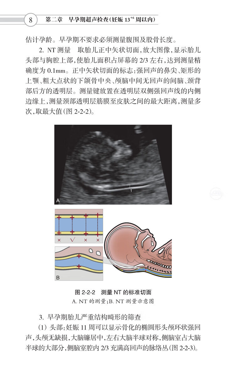 医学 妇产科学 中国产科超声检查指南 中国医师协会超声医师分会 妇