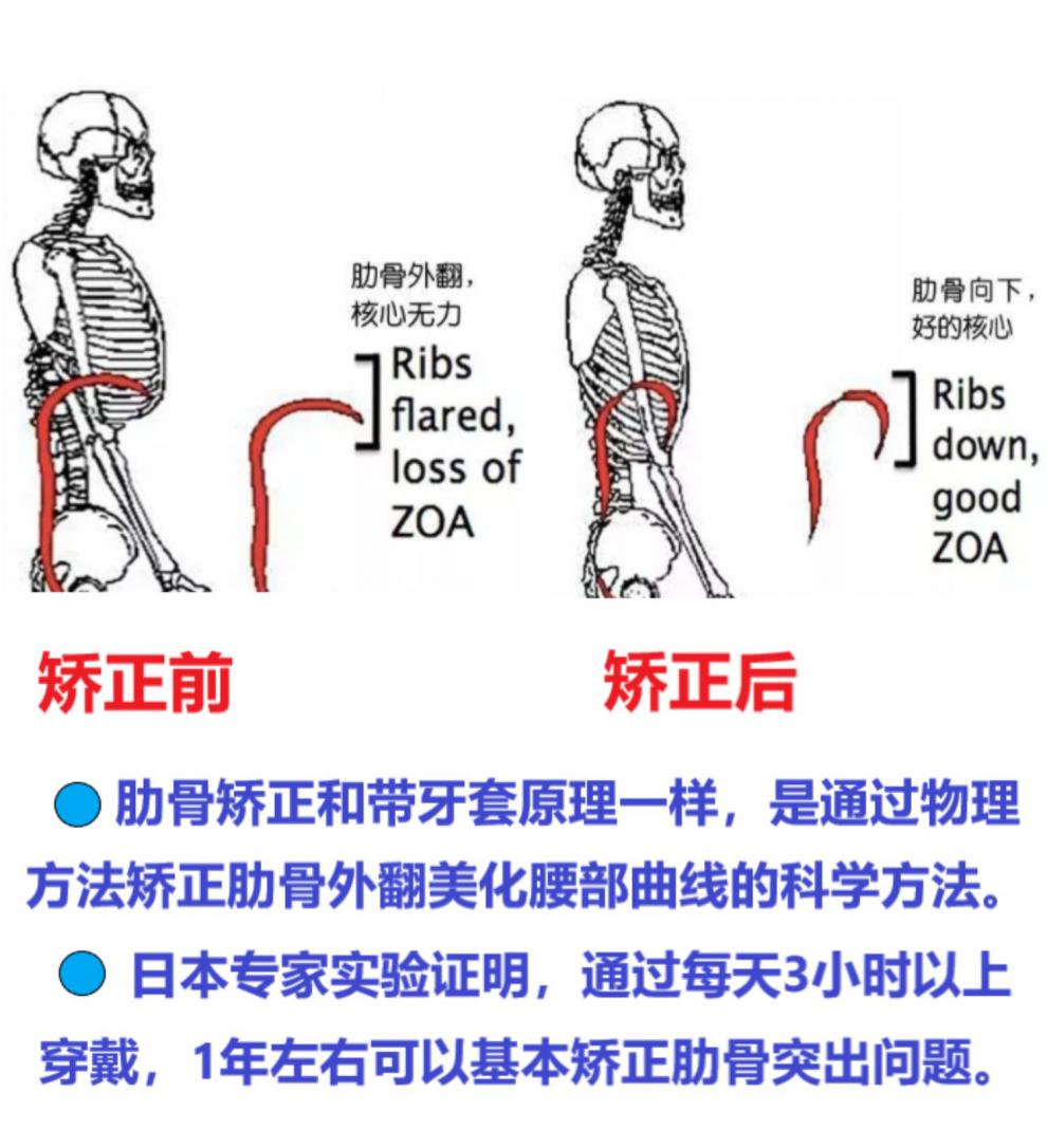 老年人贝贝佳产后驼背背佳斜肩坐姿肋骨外翻挺胸束腰收腹 旗舰款/肋骨