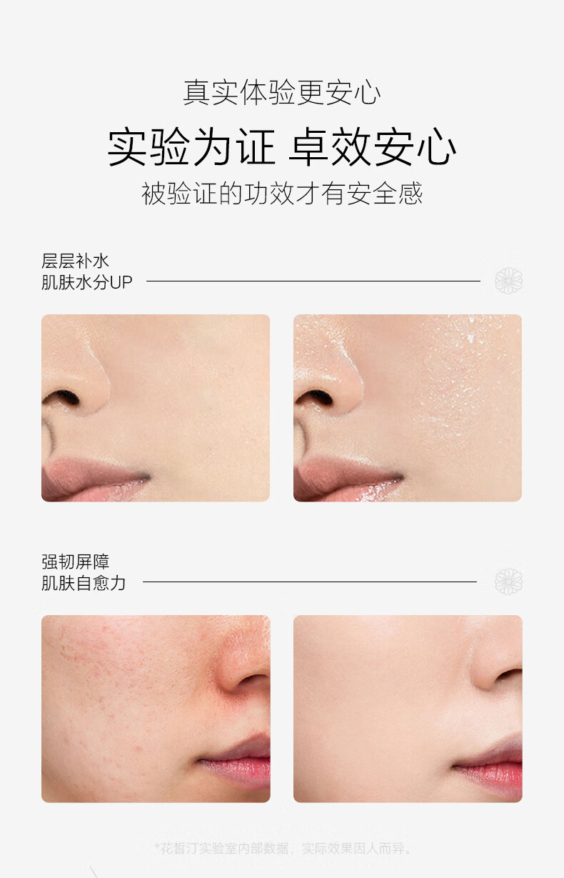 花皙汀（VOCCETIN）花皙汀山茶花沁透舒缓水乳套装敏感肌补水保湿礼盒护肤品送女友B 水120ml 乳120g