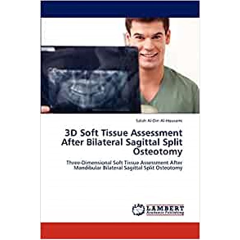 按需印刷3D Soft Tissue Assessment After Bilateral Sagittal Split Osteotomy[9783659295416]