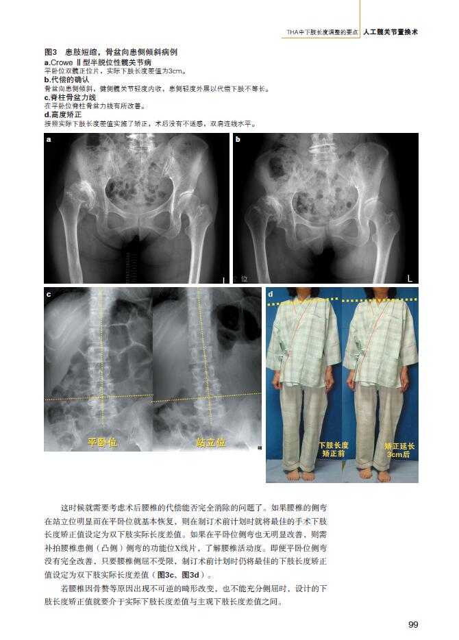 人工关节置换术并发症的处理人工膝关节置换术假体松动感染骨折静脉血栓人工髋关节置换术人工全肘关节 岩本幸英 摘要书评试读 京东图书