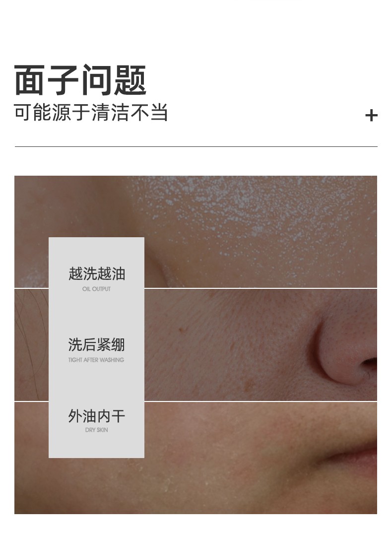 【满婷男士净爽洁面乳】除螨洗面奶150ml除螨虫清洁毛孔无皂基控油保湿去螨虫螨婷洁面膏 男士专用净爽除螨洁面乳150ml一瓶