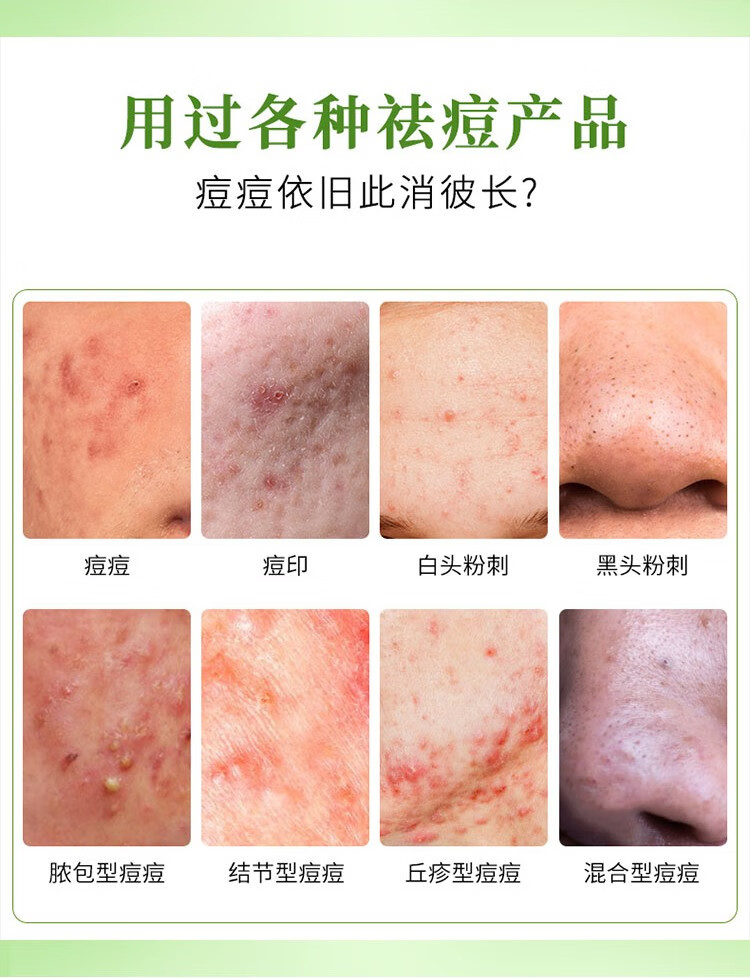 自然乐园（NATURE REPUBLIC）芦荟胶抗痘淡印舒缓保湿凝胶全身面部秋冬季补水面霜晒后修护 250ml