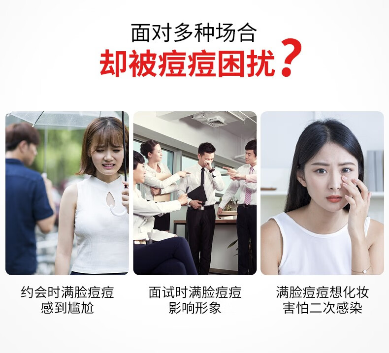 花恩诗无酸祛痘膏 祛痘舒缓霜净颜去痘闭口粉刺修复痘印痘坑提亮肤色 【三支】针对反复痘油肌