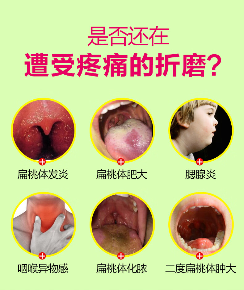 咽扁贴扁桃体咽喉贴炎扁桃体肥大肿大贴小儿儿童发炎咽扁清穴位磁疗贴