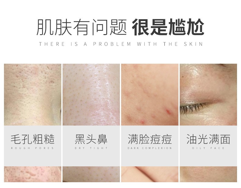 洁芙泉男士洗面奶控油抗痘清爽去黑头洁面乳去角质深层清洁清爽去油护肤品补水保湿