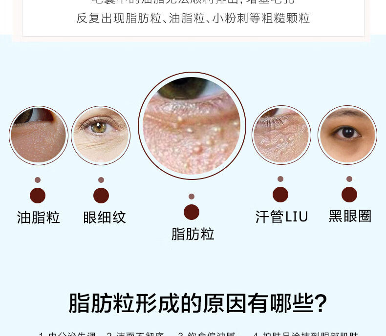 去脂肪粒眼霜去除油脂粒去眼袋黑眼圈眼部眼角纹精华素