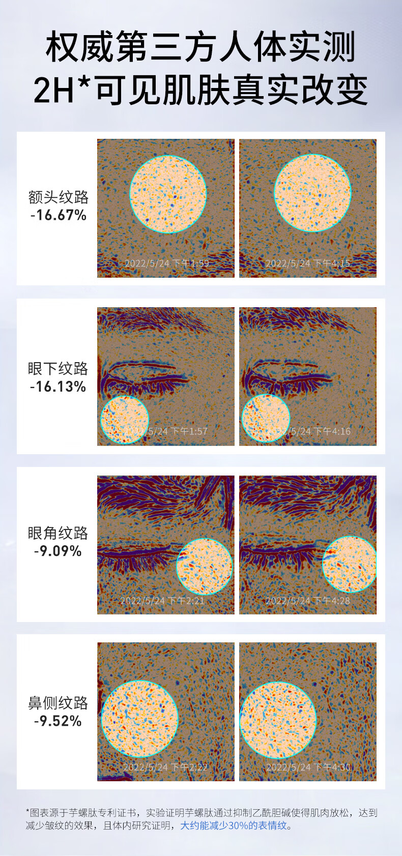 NACO蓝铜胜肽次抛面部精华液抗皱提拉紧致皮肤淡细纹舒缓改善护肤品 1.2ml*30支（到手35支）