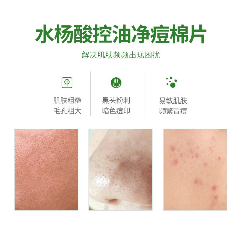 STRIDEX美国施颜适 水杨酸棉片刷闭口酸祛痘痘印清洁粉刺黑头收缩毛孔 0.5%水杨酸含量55片（温和型）