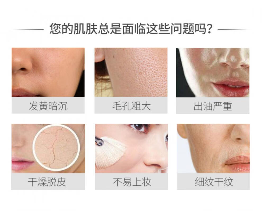 泊蝶vc水净润清滢爽肤水补水保湿化妆喷雾女男温和滋润干燥缺水粗糙肌 500g/mL*2