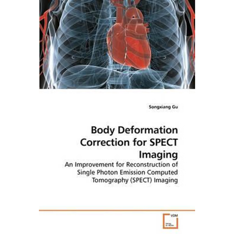 按需印刷Body Deformation Correction for SPECT Imaging[9783639247367]