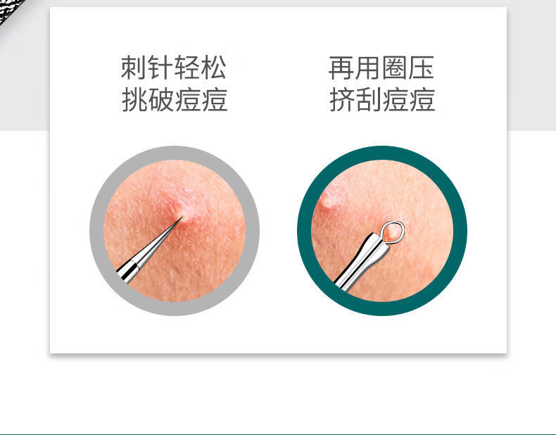 【挤痘】暗疮针粉刺针全套挤痘痘黑头排针院专用美容针 大小组合粉刺