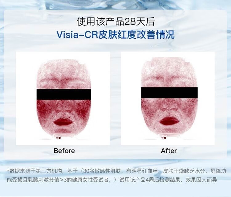 绽妍皮肤保湿修护贴修红强韧屏障滋润敏肌护理面部膜日常维稳舒缓补水 【囤货装】皮肤修护贴4盒20片