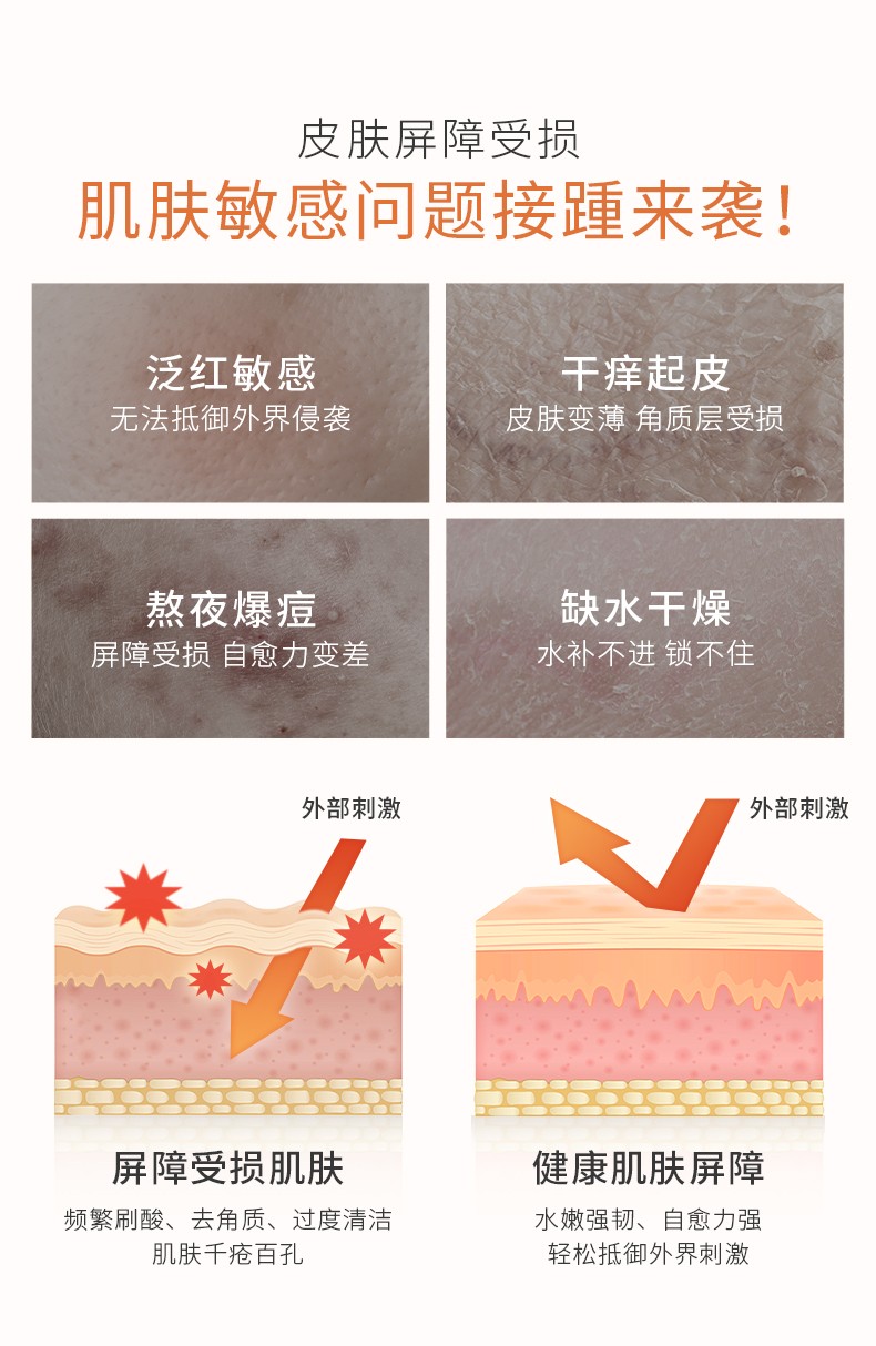透真（LUCENBASE）神经酰胺水乳护肤品套装补水保湿舒缓镇静修护干敏化妆品礼盒装 【舒缓泛红】神经酰胺3件套礼盒