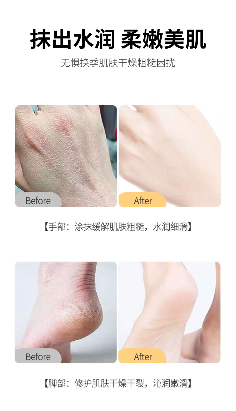 野森博士（DR. YS）蛇油防冻裂膏保湿润肤防干燥皴裂修护护手足霜 蛇油防冻防裂补水霜  100g*3瓶