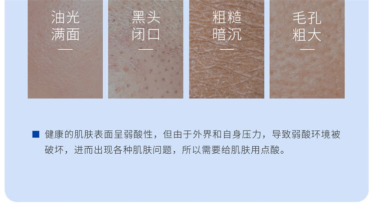 ddg 五酸棉片温和清洁平闭口粉刺水杨酸果酸收缩毛孔新手 五酸棉片-50片