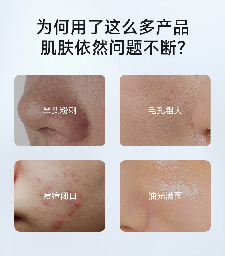 COCOAMELIA1970CCA壬二酸凝胶祛痘黑头粉刺淡化痘印祛痘膏收缩毛孔男女20g CCA壬二酸凝胶