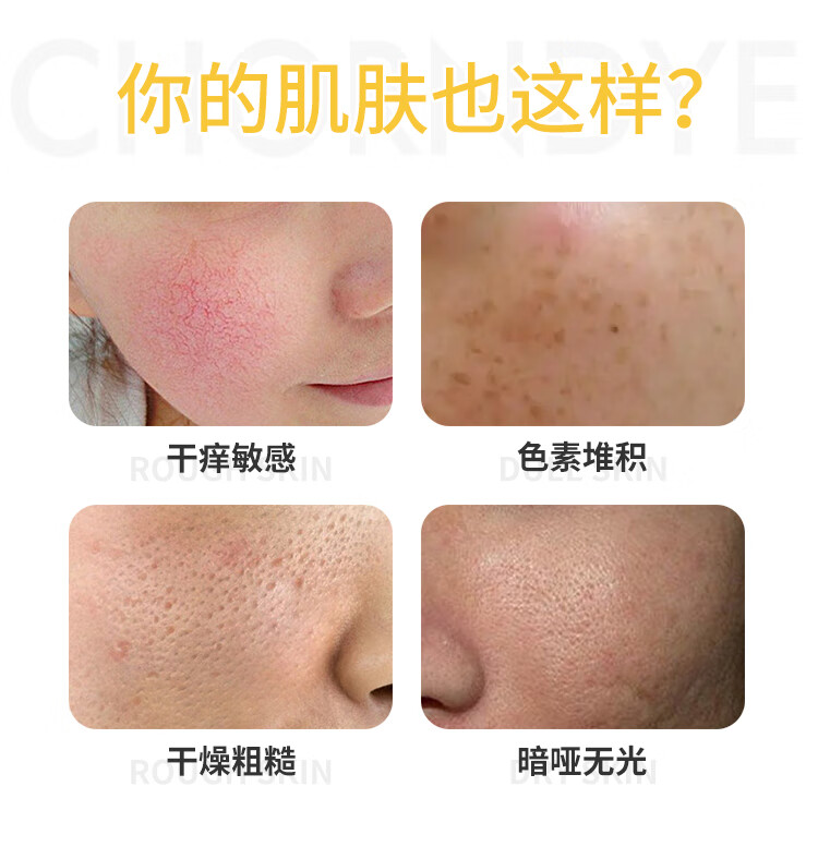 自然妍（CHORNDYE） 软膜粉面膜粉1000g洋甘菊玫瑰茶树美容院专用自制修护提亮肤色补水保湿女 茶树薄荷祛痘软膜粉