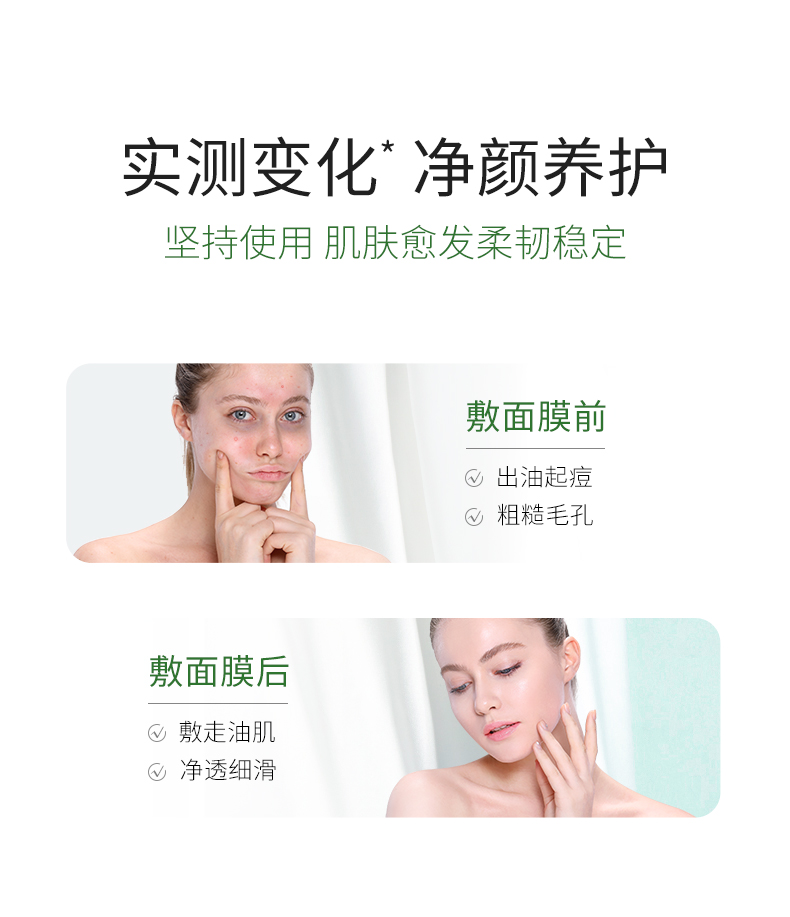 冰菊（BingJu）茶树油水盈清颜面膜补水保湿亮肤 5盒/50片