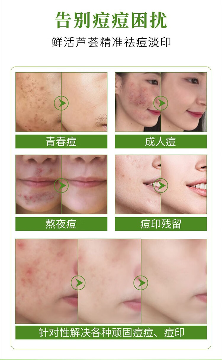 自然乐园（NATURE REPUBLIC）芦荟胶抗痘淡印舒缓保湿凝胶全身面部秋冬季补水面霜晒后修护 250ml