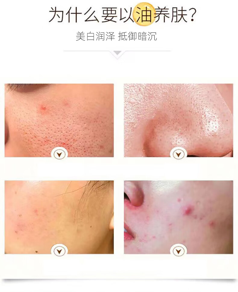 SKSH美白祛斑溶斑油兰花油护肤精华精油 3盒溶斑油